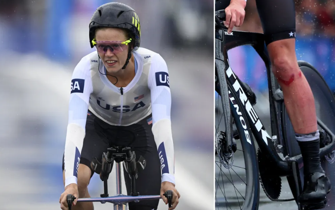 Knibb nỗ lực thi đấu dù liên tục ngã và chấn thương ở chung kết nội dung xe đạp tính giờ ở Olympic 2024.