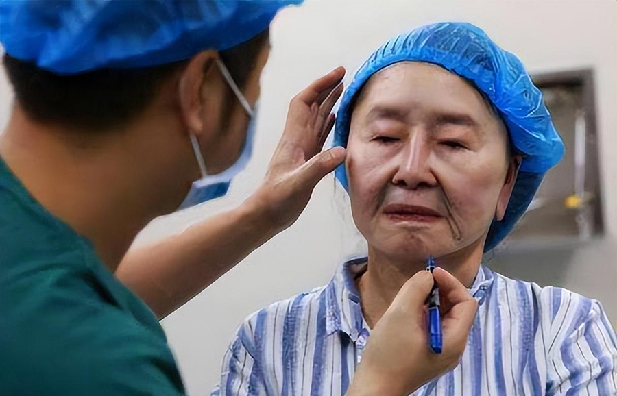 da-3-3-7926-1726965237 Hồ Quyên được phẫu thuật thẩm mỹ năm 2015. Ảnh: 163.com