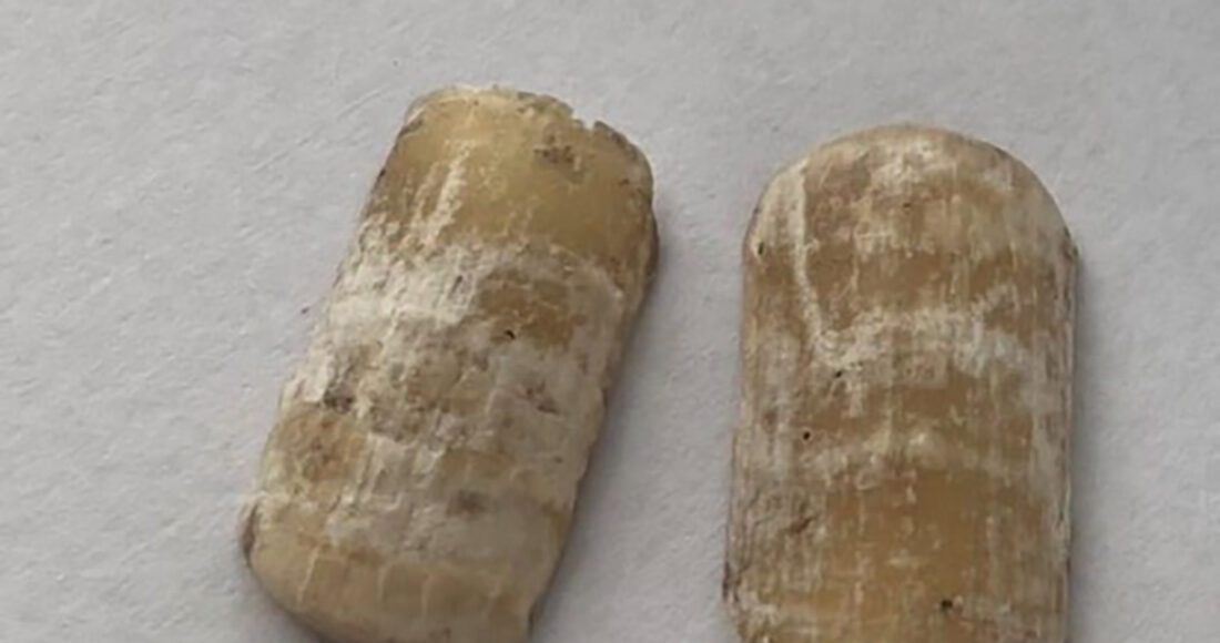 Móng tay giả ở bàn tay của nạn nhân. Ảnh: Yên Khánh