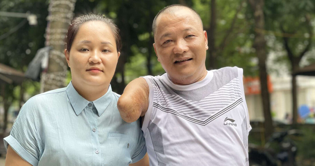 Vợ chồng anh Đạt, chị Thương chờ đợi bố trị xạ tại Hà Nội, tháng 8/2024. Ảnh: Hải Hiền