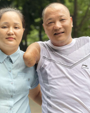 Vợ chồng anh Đạt, chị Thương chờ đợi bố trị xạ tại Hà Nội, tháng 8/2024. Ảnh: Hải Hiền