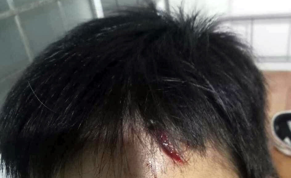Vết thương trên trán của bé trai 10 tuổi. Ảnh: Gia đình cung cấp